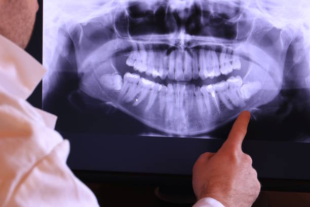 Best Pediatric Emergency Dentist in Stanton, MI
