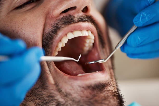 Best Emergency Dentist for Knocked-Out Tooth in Stanton, MI
