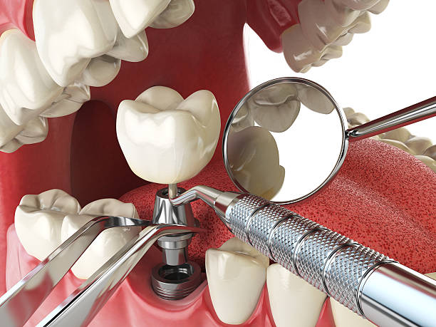 Best Emergency Cosmetic Dentistry in Stanton, MI